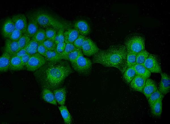 ATG16L1 Rabbit Polyclonal Antibody