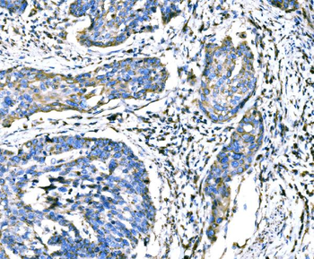 ATG16L1 Rabbit Polyclonal Antibody
