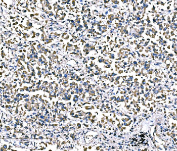 ATG16L1 Rabbit Polyclonal Antibody