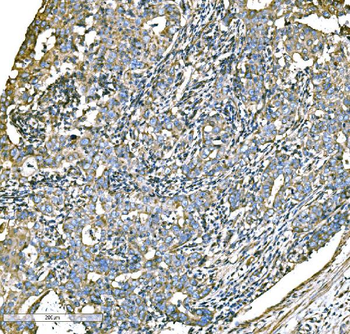 ATG16L1 Rabbit Polyclonal Antibody
