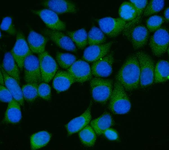 AP2M1 Rabbit Polyclonal Antibody