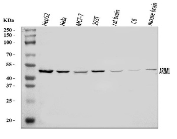 AP2M1 Rabbit Polyclonal Antibody