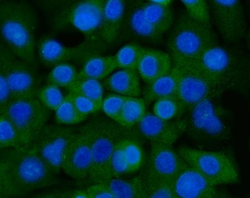 Ankyrin erythroid/ANK/ANK1 Rabbit Polyclonal Antibody