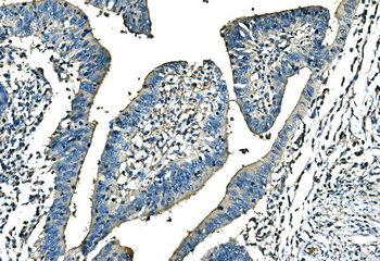 Ankyrin erythroid/ANK/ANK1 Rabbit Polyclonal Antibody
