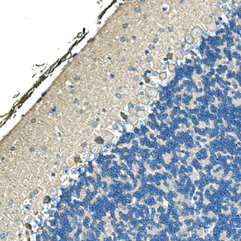Ankyrin erythroid/ANK/ANK1 Rabbit Polyclonal Antibody