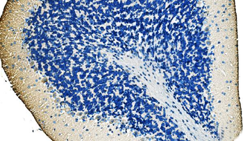 Ankyrin erythroid/ANK/ANK1 Rabbit Polyclonal Antibody
