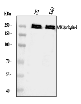 Ankyrin erythroid/ANK/ANK1 Rabbit Polyclonal Antibody
