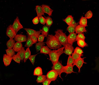 ADAR1/ADAR Rabbit Polyclonal Antibody