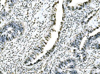 ADAR1/ADAR Rabbit Polyclonal Antibody