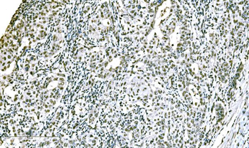 ADAR1/ADAR Rabbit Polyclonal Antibody