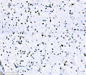 ADAR1/ADAR Rabbit Polyclonal Antibody