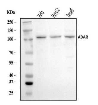 ADAR1/ADAR Rabbit Polyclonal Antibody