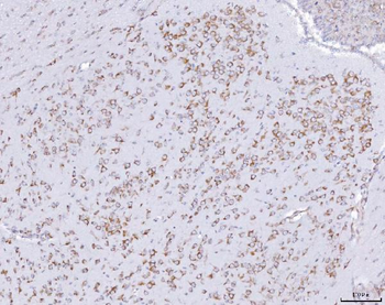PRKRA Rabbit Polyclonal Antibody