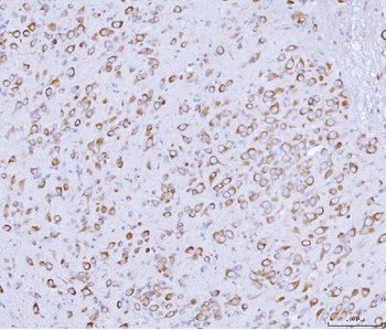 PRKRA Rabbit Polyclonal Antibody
