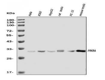 PRKRA Rabbit Polyclonal Antibody