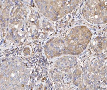 TTC11/FIS1 Rabbit Polyclonal Antibody