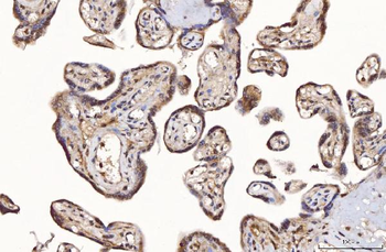 TTC11/FIS1 Rabbit Polyclonal Antibody