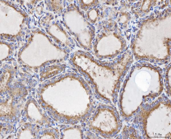 TTC11/FIS1 Rabbit Polyclonal Antibody