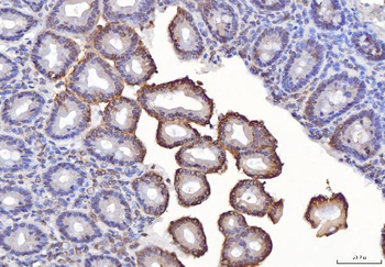 TTC11/FIS1 Rabbit Polyclonal Antibody