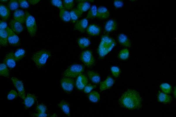 Eph receptor A3/EPHA3 Rabbit Polyclonal Antibody