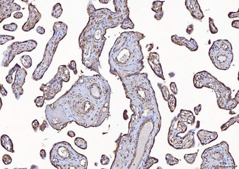 Eph receptor A3/EPHA3 Rabbit Polyclonal Antibody
