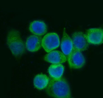 EIF5A Rabbit Polyclonal Antibody