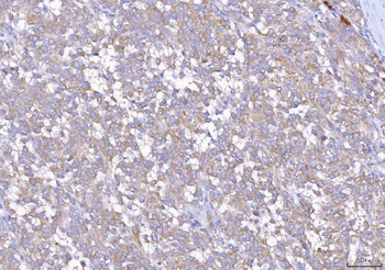 EIF5A Rabbit Polyclonal Antibody