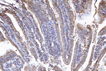 EIF5A Rabbit Polyclonal Antibody