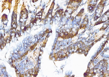 EIF5A Rabbit Polyclonal Antibody