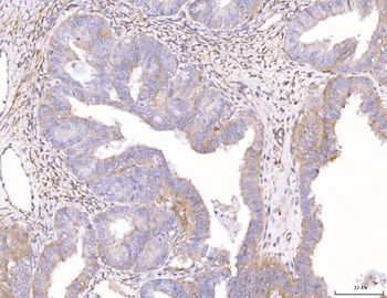 ENPP1/PC1 Rabbit Polyclonal Antibody