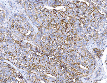 ENPP1/PC1 Rabbit Polyclonal Antibody