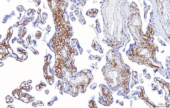 ENPP1/PC1 Rabbit Polyclonal Antibody