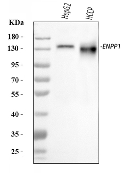 ENPP1/PC1 Rabbit Polyclonal Antibody