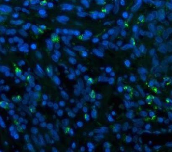 CD68 Rabbit Polyclonal Antibody
