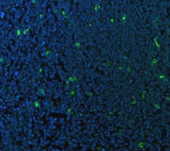 CD68 Rabbit Polyclonal Antibody