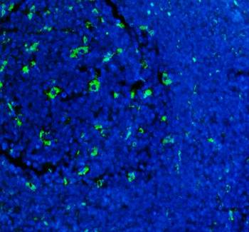 CD68 Rabbit Polyclonal Antibody