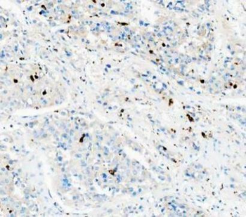 CD68 Rabbit Polyclonal Antibody