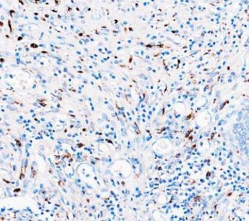 CD68 Rabbit Polyclonal Antibody