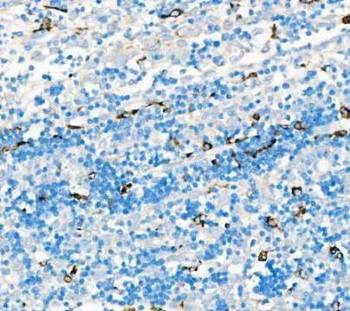 CD68 Rabbit Polyclonal Antibody