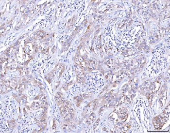 CCR7 Rabbit Polyclonal Antibody