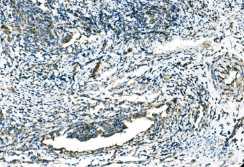 CCR2 Rabbit Polyclonal Antibody