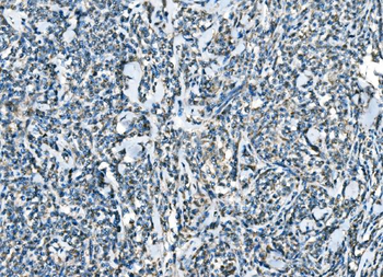 CCR2 Rabbit Polyclonal Antibody