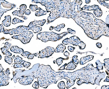 CCR2 Rabbit Polyclonal Antibody