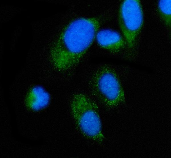 ALAS2/ASB Rabbit Polyclonal Antibody