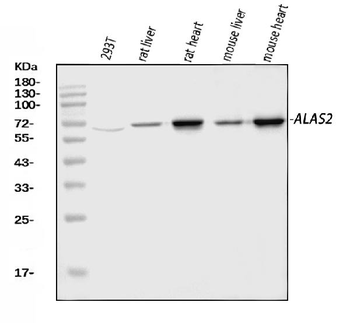 ALAS2/ASB Rabbit Polyclonal Antibody
