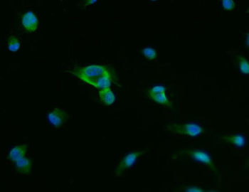 PAP/ACP3 Rabbit Polyclonal Antibody