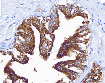 PAP/ACP3 Rabbit Polyclonal Antibody