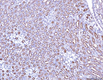 PAP/ACP3 Rabbit Polyclonal Antibody