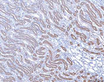 PAP/ACP3 Rabbit Polyclonal Antibody