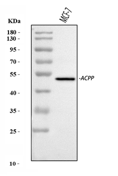 PAP/ACP3 Rabbit Polyclonal Antibody